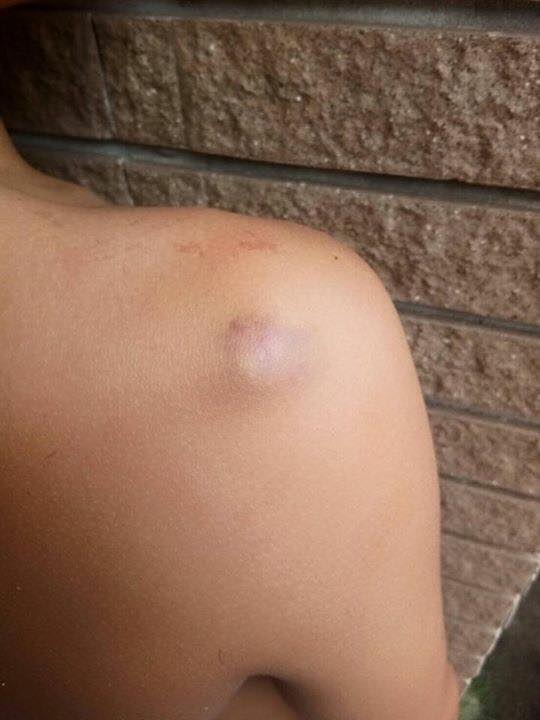 รุ่นพี่ทำร้ายรุ่นน้อง รุ่นพี่ทำร้ายรุ่นน้อง