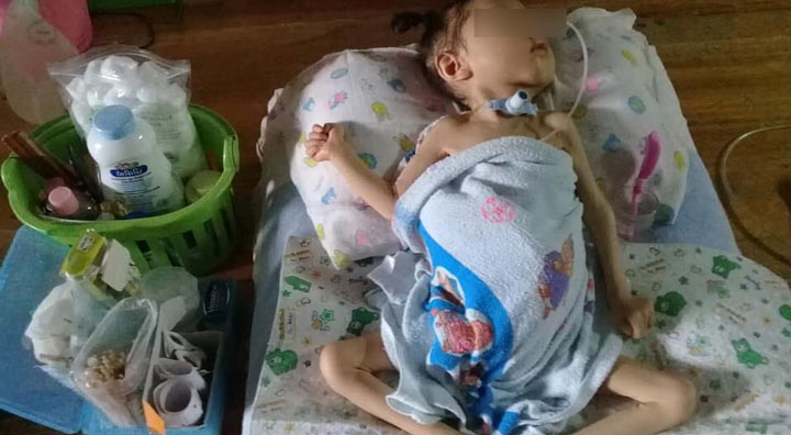 วอนช่วยเด็กหัวใจพิการแต่กำเนิด วอนช่วยเด็กหัวใจพิการแต่กำเนิด