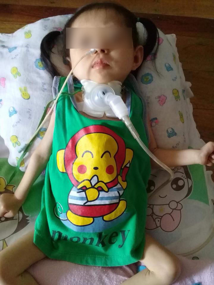 วอนช่วยเด็กหัวใจพิการแต่กำเนิด วอนช่วยเด็กหัวใจพิการแต่กำเนิด