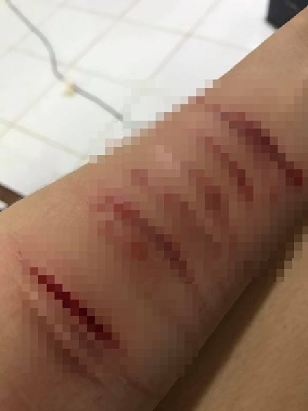 กรีดแขนตัวเอง กรีดแขนตัวเอง