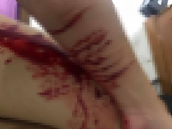 กรีดแขนตัวเอง กรีดแขนตัวเอง