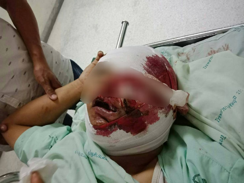 คนเมายาบ้าทำร้ายตำรวจ คนเมายาบ้าทำร้ายตำรวจ