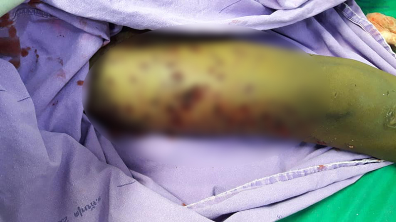 หมารุมกัดเด็ก หมารุมกัดเด็ก