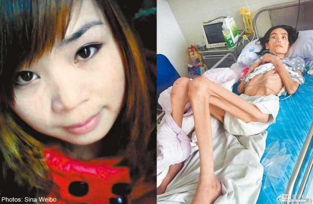 แม่เขยจีนปล่อยสะใภ้ผอมหนังติดกระดูกจนตาย แม่เขยจีนปล่อยสะใภ้ผอมหนังติดกระดูกจนตาย