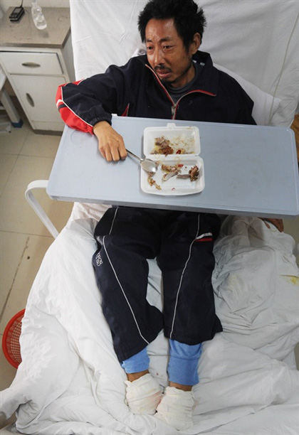 ชาวนาจีนใช้เศษแก้วตัดเท้าตัวเอง เพราะไม่มีเงินไปหาหมอ ชาวนาจีนใช้เศษแก้วตัดเท้าตัวเอง เพราะไม่มีเงินไปหาหมอ