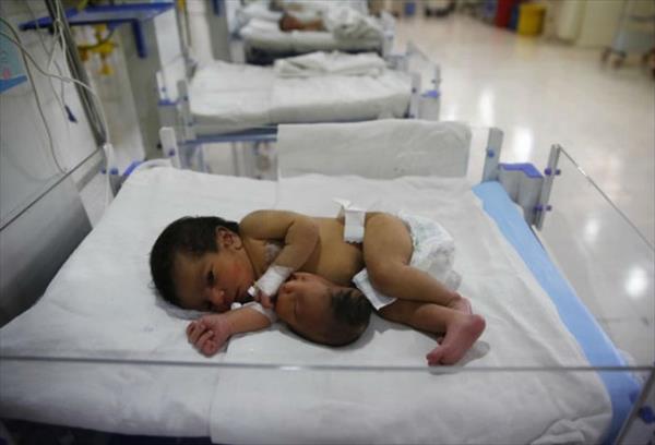 ทารกอินเดียถือกำเนิดพร้อมหัวที่ 2 โผล่จากท้อง ทารกอินเดียถือกำเนิดพร้อมหัวที่ 2 โผล่จากท้อง