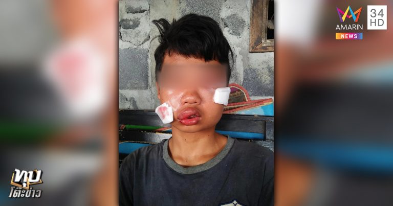 รุมกระทืบเด็กหน้าค่ายมวย รุมกระทืบเด็กหน้าค่ายมวย