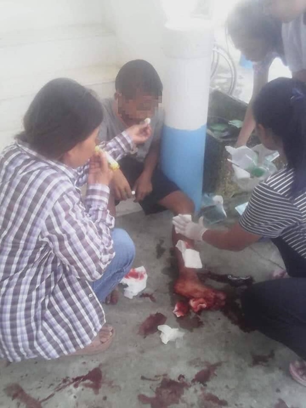 พลุระเบิดใส่เด็ก พลุระเบิดใส่เด็ก