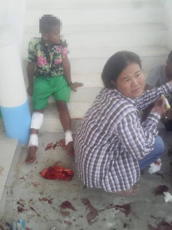 พลุระเบิดใส่เด็ก พลุระเบิดใส่เด็ก