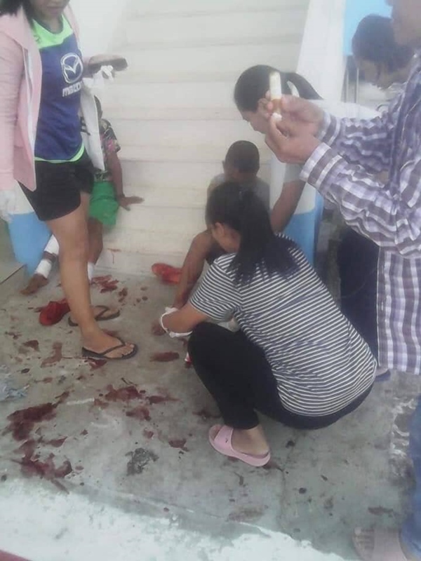 พลุระเบิดใส่เด็ก พลุระเบิดใส่เด็ก