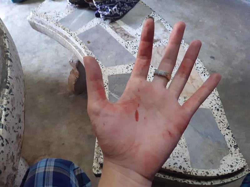 ทำร้ายร่างกายแฟน ทำร้ายร่างกายแฟน