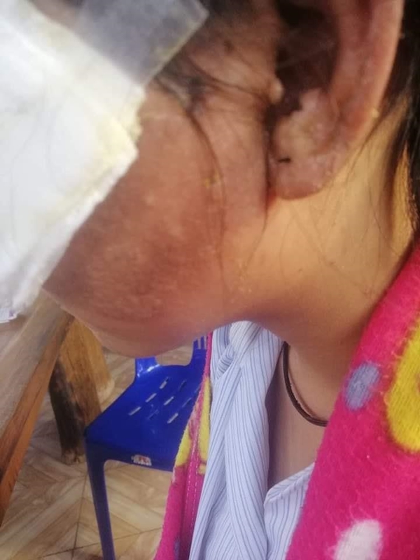 เด็ก ม.3 สาดน้ำร้อนใส่หน้าเด็ก ม.1 เด็ก ม.3 สาดน้ำร้อนใส่หน้าเด็ก ม.1