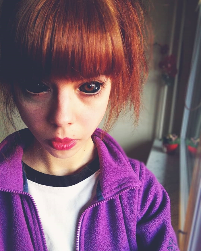 สักตาขาวจนตาบอด สักตาขาวจนตาบอด