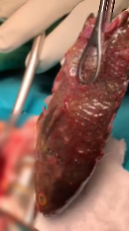 ปลาหมอติดคอ ปลาหมอติดคอ