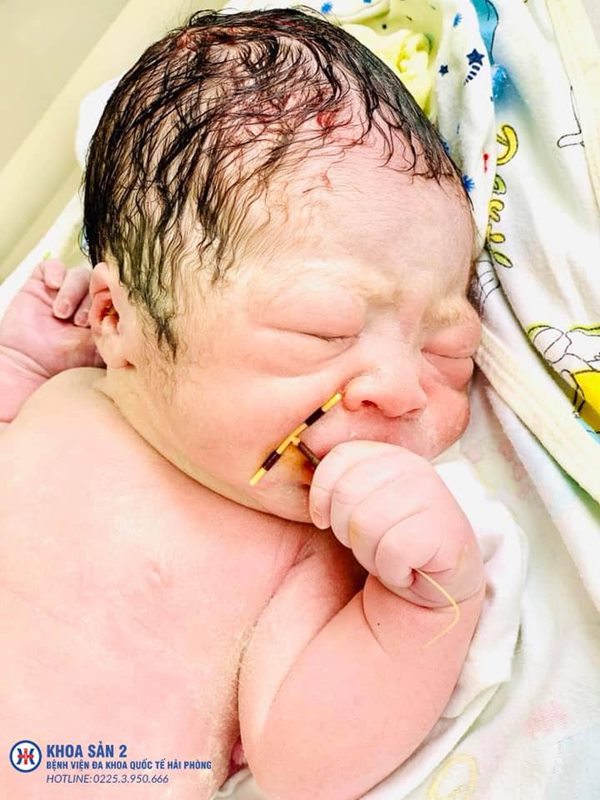 หนูน้อยคลอดพร้อมห่วงคุมกำเนิด หนูน้อยคลอดพร้อมห่วงคุมกำเนิด