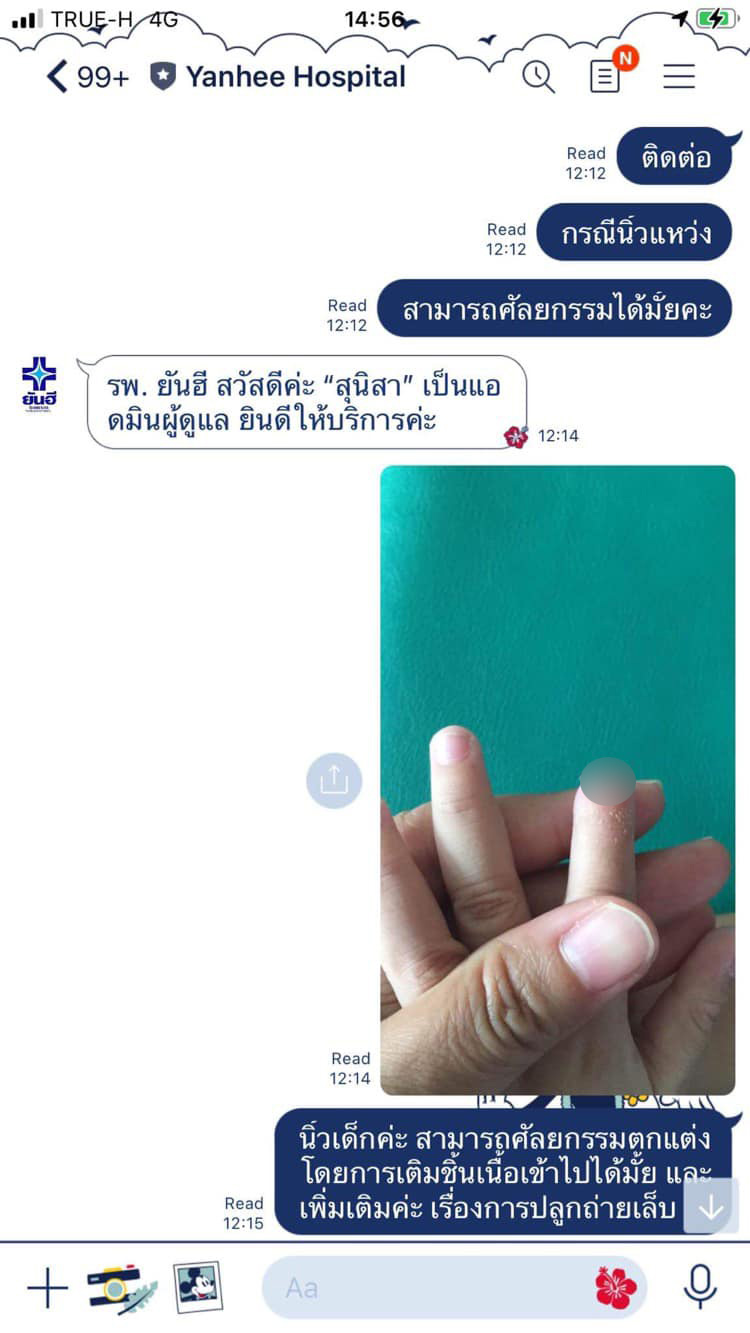 ครูปิดประตูหนีบนักเรียนนิ้วขาด ครูปิดประตูหนีบนักเรียนนิ้วขาด