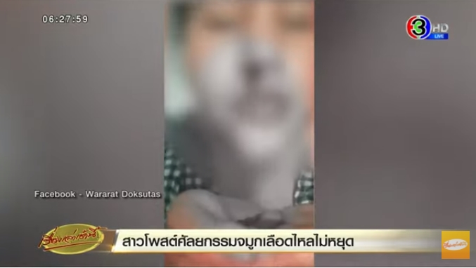 ศัลยกรรมจมูกพลาด ศัลยกรรมจมูกพลาด