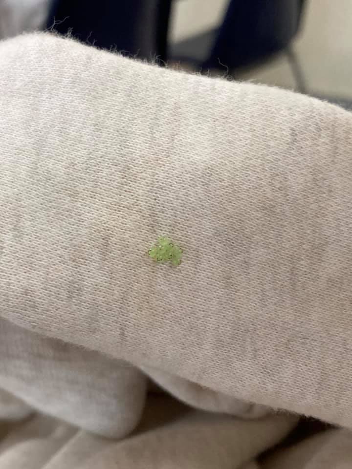 ไข่ยิ้ม คืออะไร ไข่ยิ้ม คืออะไร