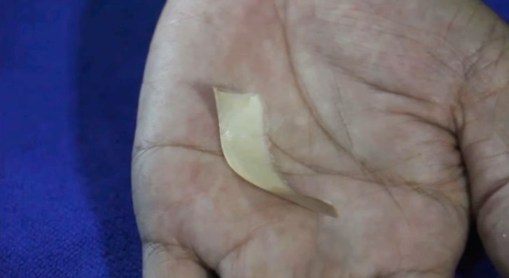 เกล็ดพญานาค เกล็ดพญานาค