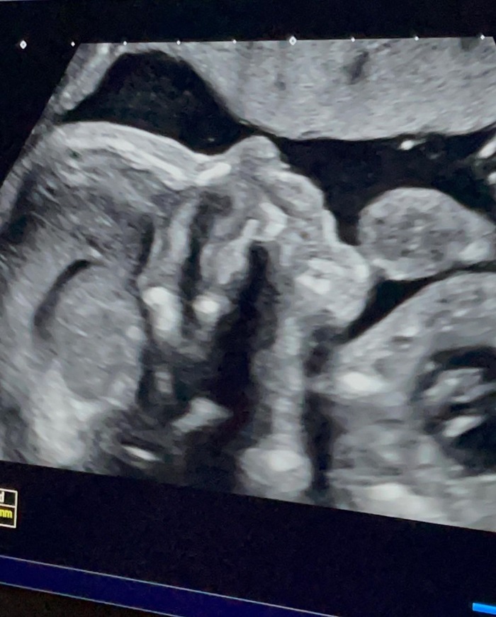 นักบิดแต่งงานกับน้องสาวบุญธรรม นักบิดแต่งงานกับน้องสาวบุญธรรม