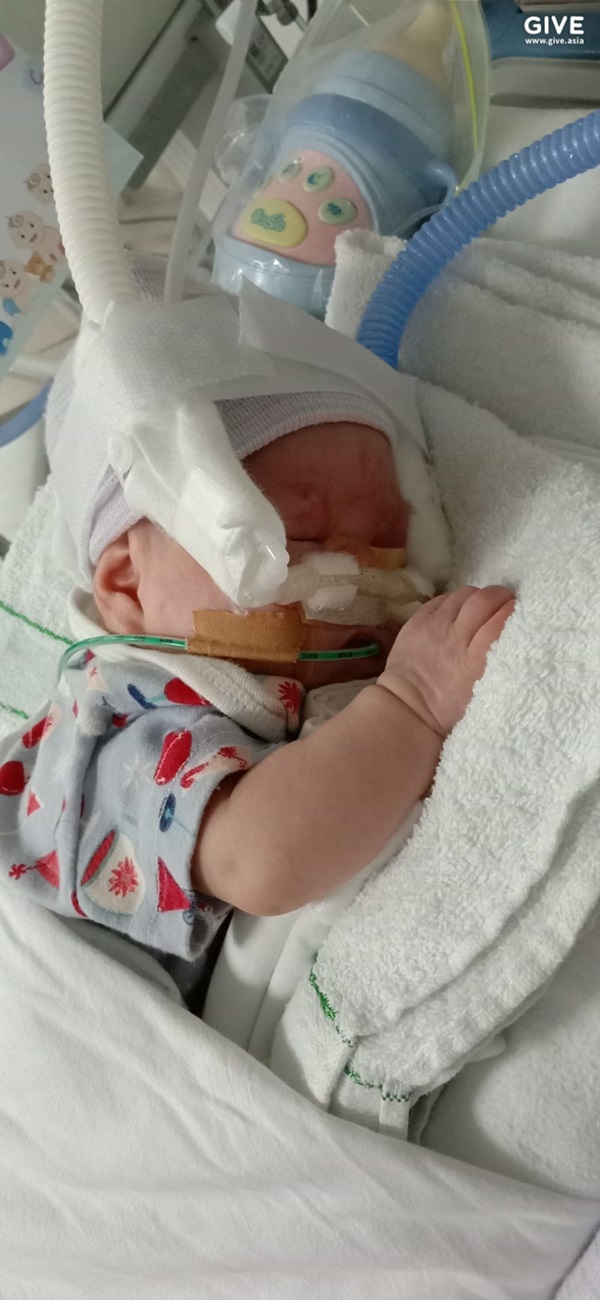 ทารกตัวเล็ก หนัก 2 ขีด ทารกตัวเล็ก หนัก 2 ขีด