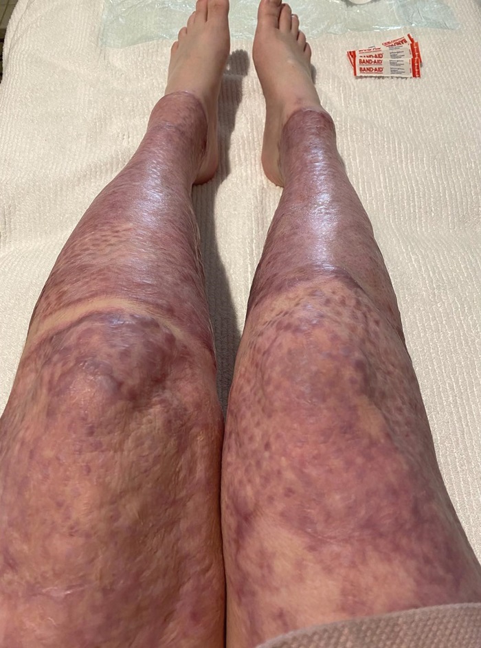 รอดตายจากภูเขาไฟระเบิด รอดตายจากภูเขาไฟระเบิด