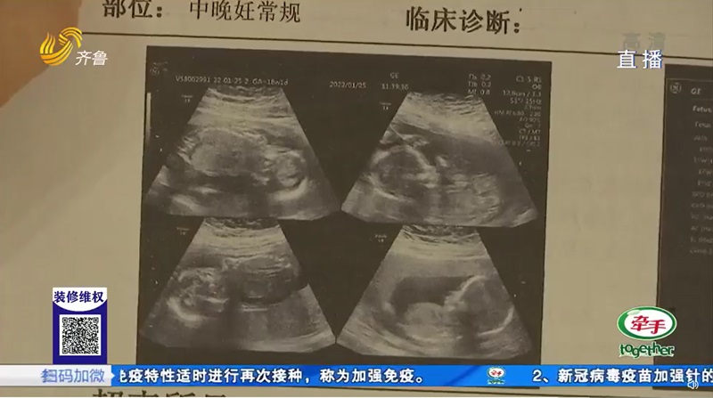 แฝด 4 แฝด 4