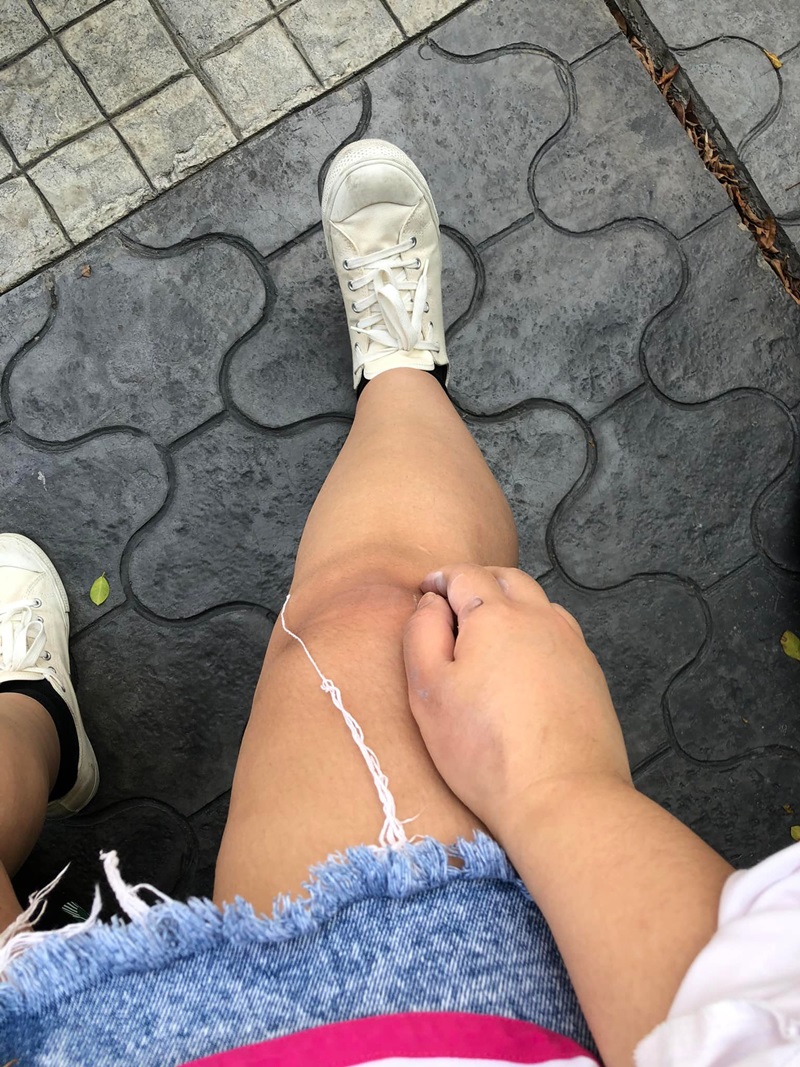 ไม้กั้นตกใส่หัว ไม้กั้นตกใส่หัว