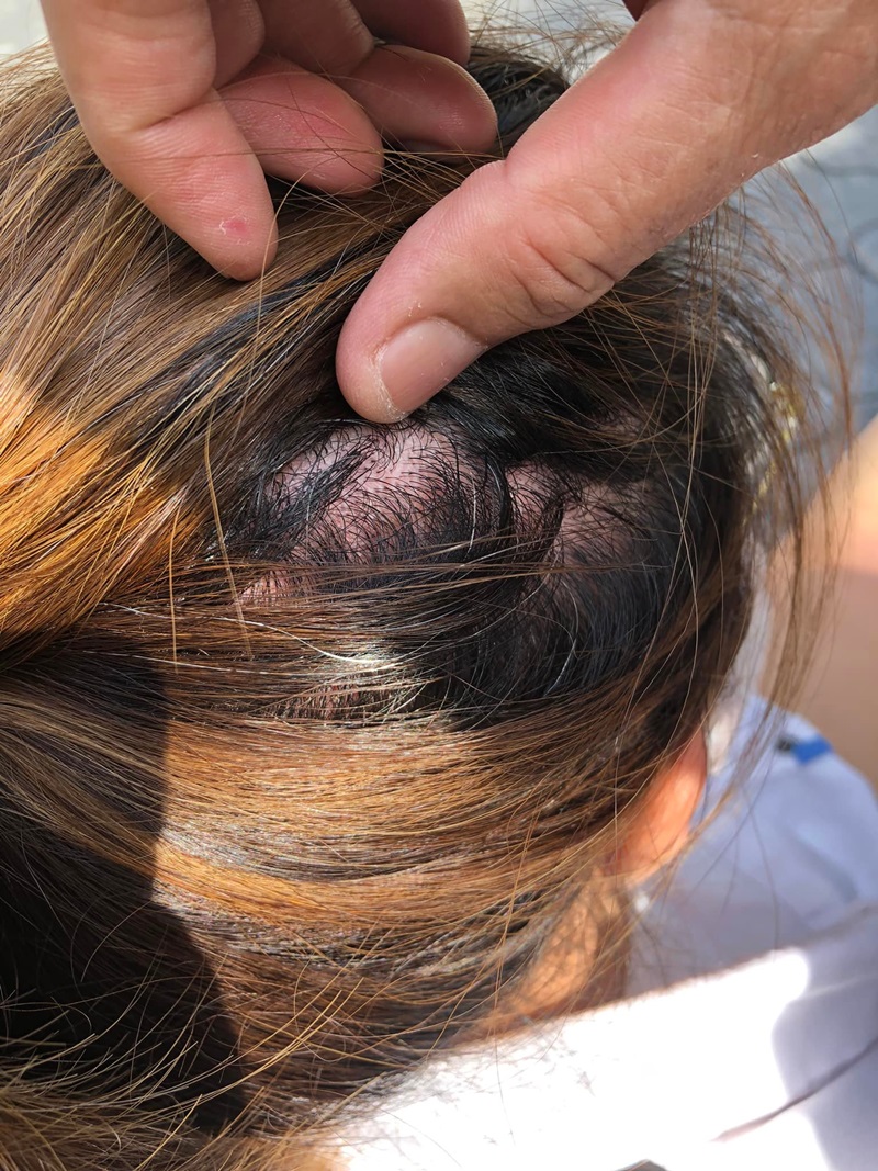 ไม้กั้นตกใส่หัว ไม้กั้นตกใส่หัว