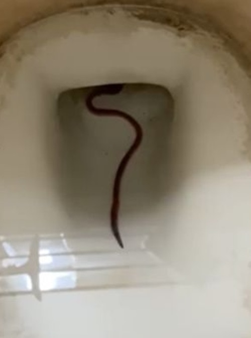 ชักโครกสกปรก ชักโครกสกปรก