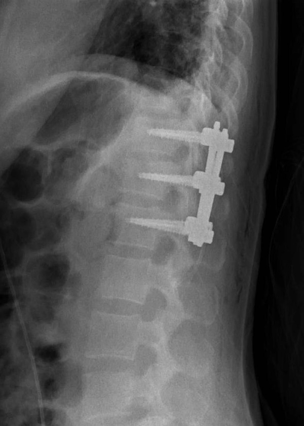 ไฟไหม้รีสอร์ตโซเนวา ไฟไหม้รีสอร์ตโซเนวา
