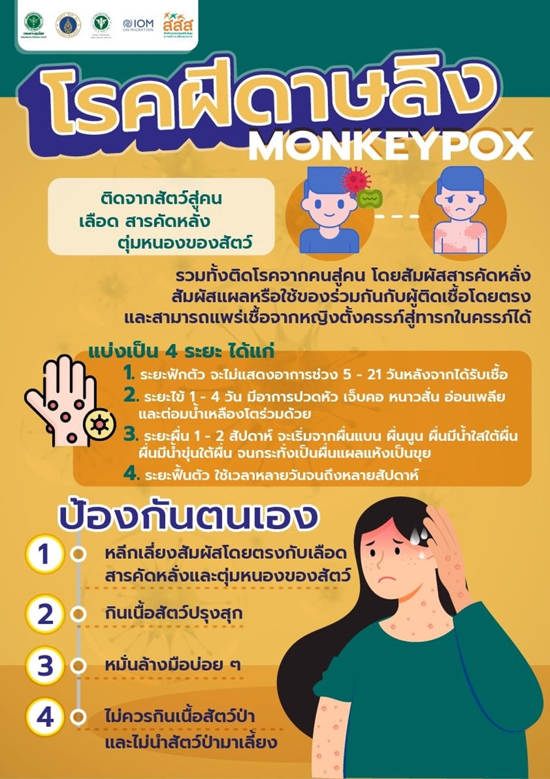 ฝีดาษลิง ฝีดาษลิง