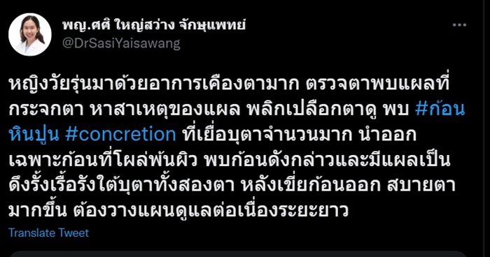 หินปูนในตา หินปูนในตา