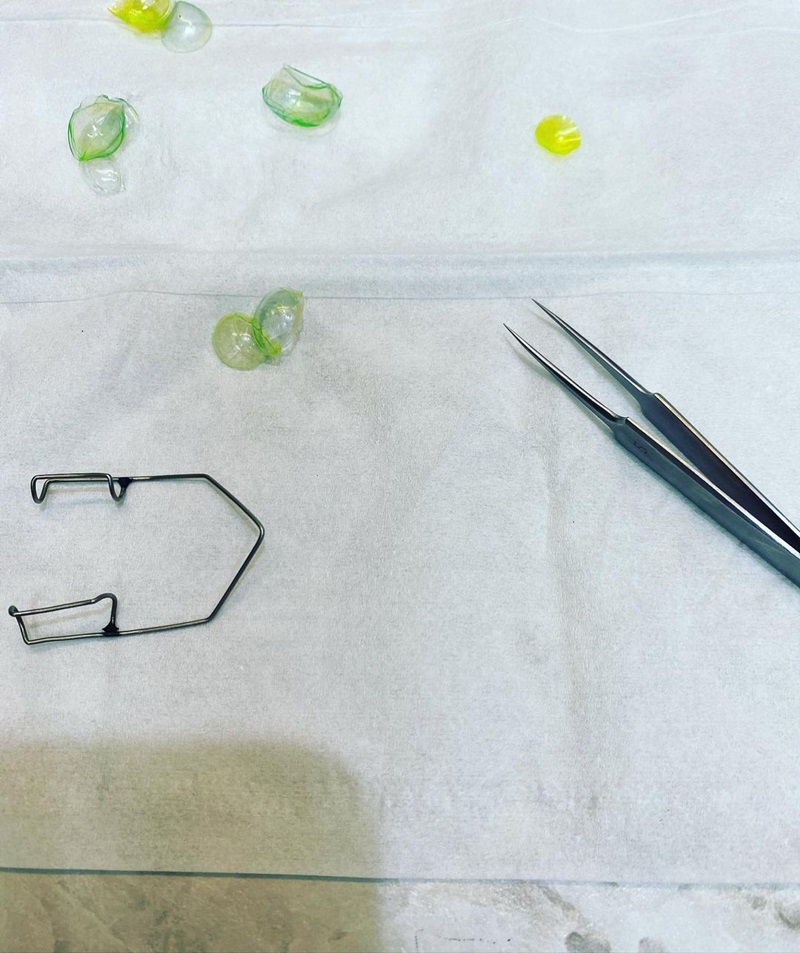 ลืมถอดคอนแทคเลนส์ ลืมถอดคอนแทคเลนส์