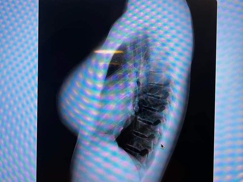 Suzuki Fumina Suzuki Fumina