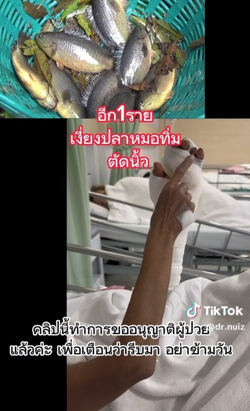 เงี่ยงปลาทิ่ม เงี่ยงปลาทิ่ม