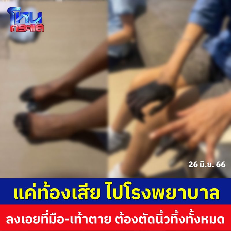 มือเท้าดำ มือเท้าดำ