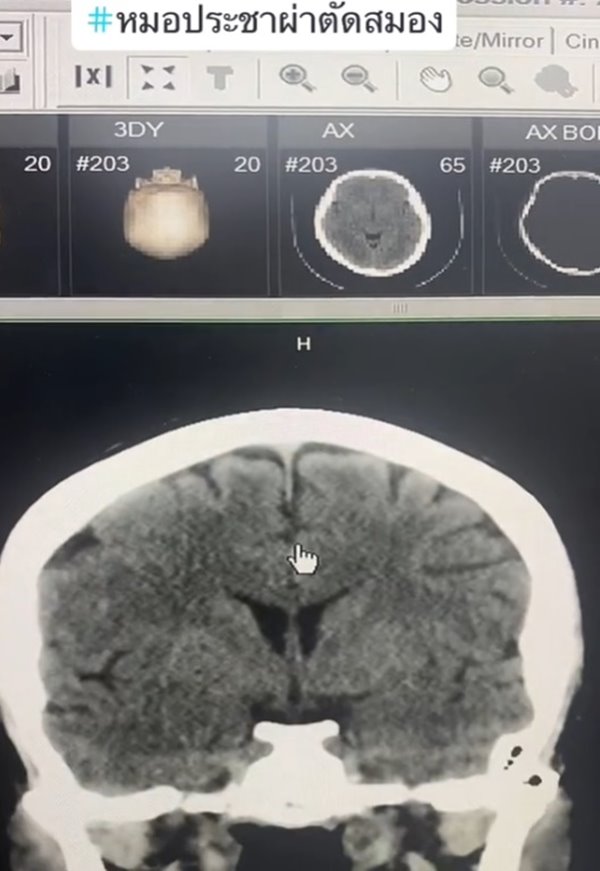 สมอง สมอง