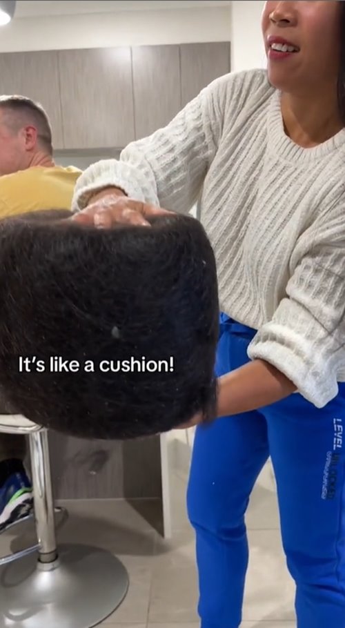 สะสมเส้นผม สะสมเส้นผม