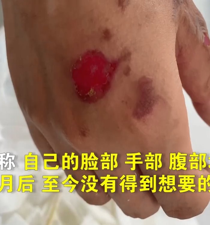 ไฟลวก ไฟลวก