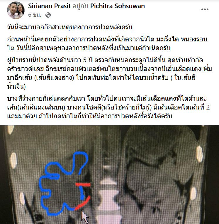 ปวดหลัง ปวดหลัง