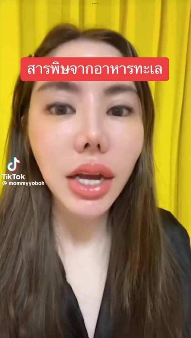 แพ้สารพิษจากอาหารทะเล แพ้สารพิษจากอาหารทะเล