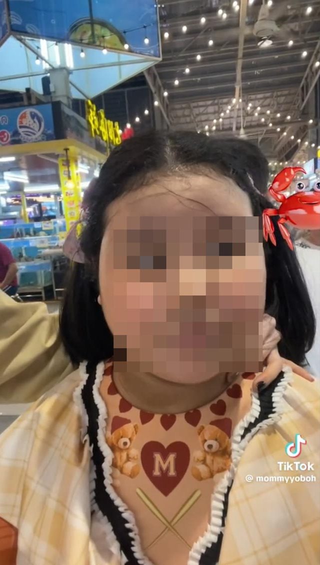 แพ้สารพิษจากอาหารทะเล แพ้สารพิษจากอาหารทะเล