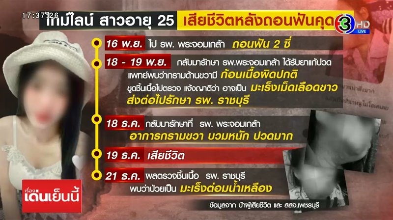 ถอนฟันแล้วตาย ถอนฟันแล้วตาย