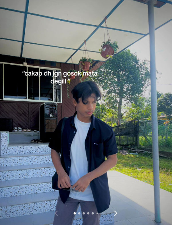 ขยี้ตา ขยี้ตา