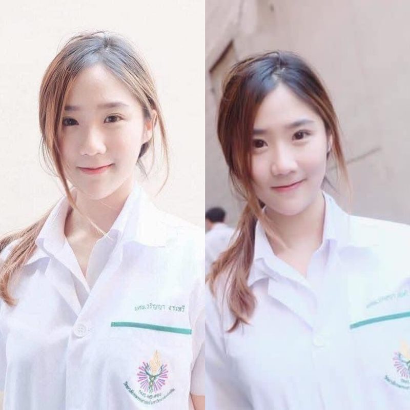 หมอลิลลี่ แพทย์หญิงวรัญญา งานทวี หมอลิลลี่ แพทย์หญิงวรัญญา งานทวี