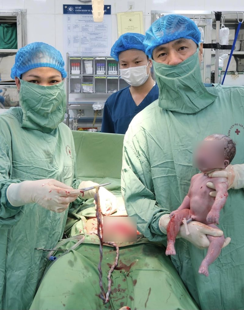 เคสหายาก ผ่าคลอดทารกมีสายสะดือพันรอบคอ 9 รอบ เคสหายาก ผ่าคลอดทารกมีสายสะดือพันรอบคอ 9 รอบ