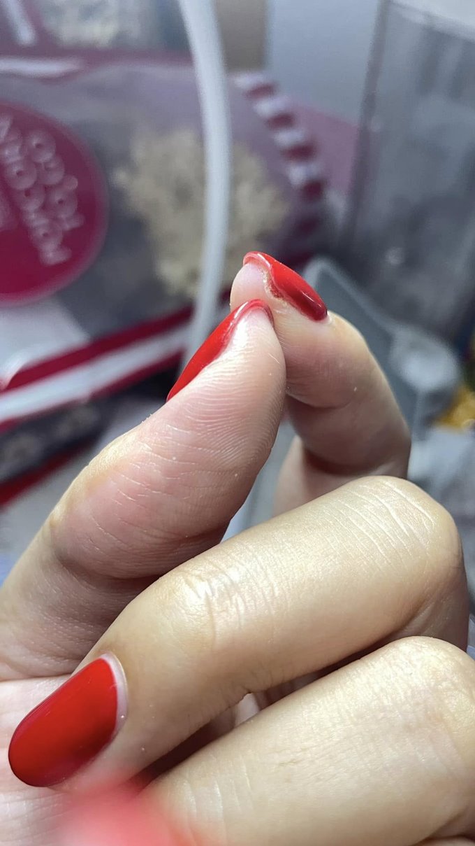 เตือนภัยคนชอบทำเล็บเจล เล็บติดเชื้อ แต่ร้านกลับเสนอทำฟรีอีก 1 เดือน เตือนภัยคนชอบทำเล็บเจล เล็บติดเชื้อ แต่ร้านกลับเสนอทำฟรีอีก 1 เดือน