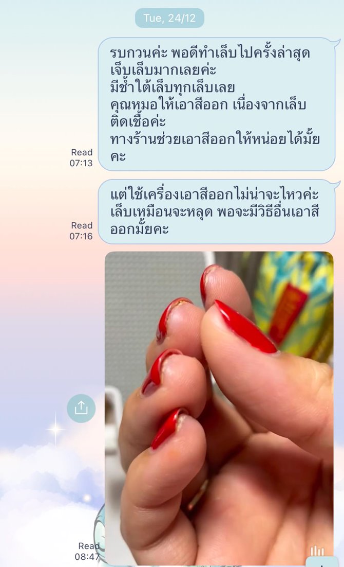 เตือนภัยคนชอบทำเล็บเจล เล็บติดเชื้อ แต่ร้านกลับเสนอทำฟรีอีก 1 เดือน เตือนภัยคนชอบทำเล็บเจล เล็บติดเชื้อ แต่ร้านกลับเสนอทำฟรีอีก 1 เดือน