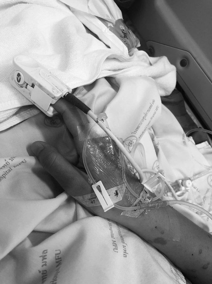 สาวแพ้ยาแก้ปวด แพ้ยารุนแรง นอน ICU 36 วัน ตอนนี้ยังไม่หายดี สาวแพ้ยาแก้ปวด แพ้ยารุนแรง นอน ICU 36 วัน ตอนนี้ยังไม่หายดี